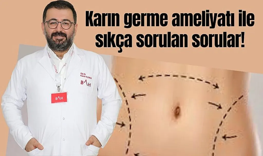 Karın germe ameliyatı ile sıkça sorulan sorular!
