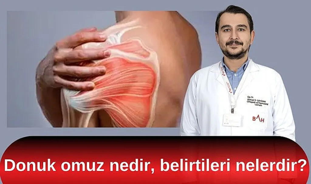 Donuk omuz nedir, belirtileri nelerdir?