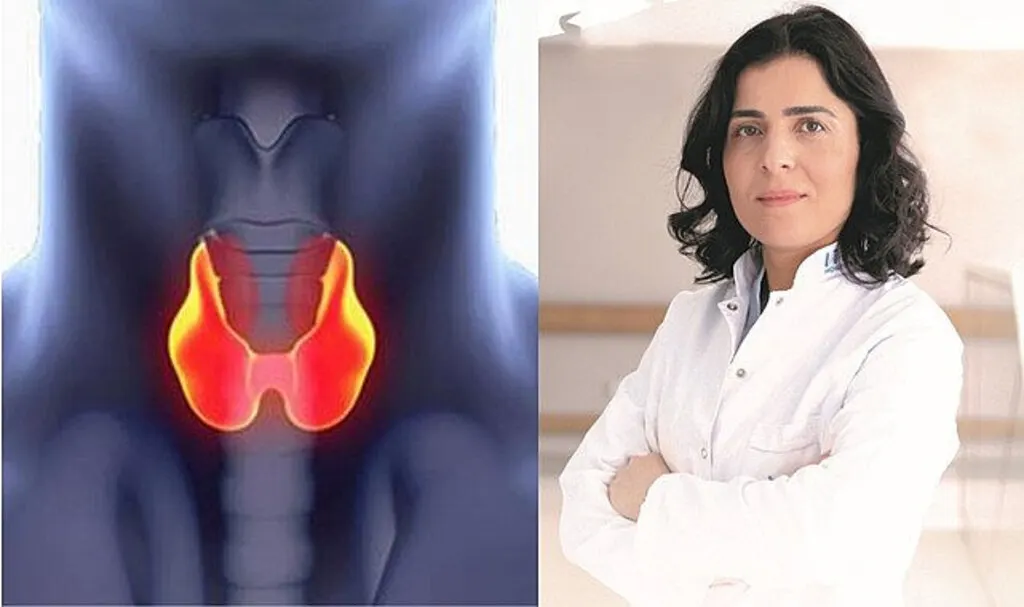 Guatrın en sık önemli nedeni iyot eksikliği