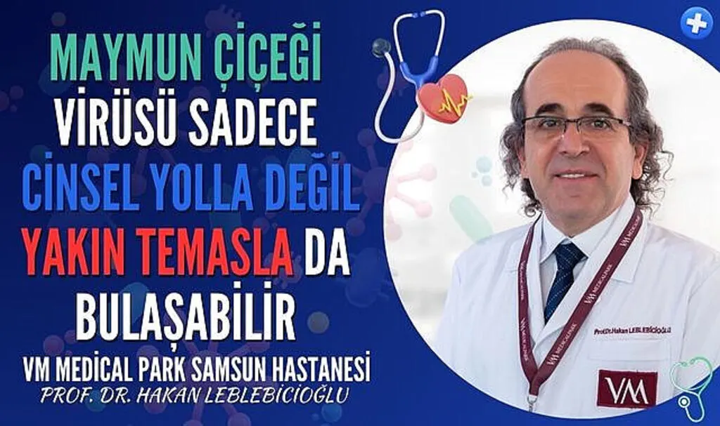 Maymun çiçeği virüsü nedir ve nasıl bulaşır?