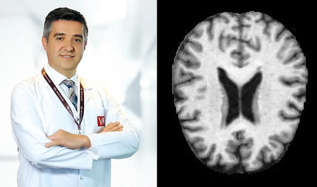 Alzheimer hastalığında erken teşhis önemli! Alzheimer nedir?