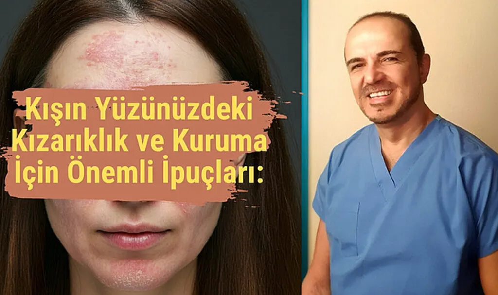 Yüzümde kızarıklık neden var, Seboreik Dermatiti nedir?