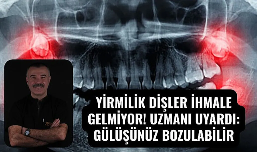 Uzman Diş Hekimi Dr. Ümit Sait Yavuz: Yirmilik dişler ne zaman çekilmeli