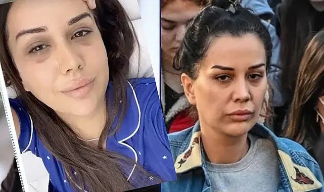 Dilan Polat neden psikiyatri servisine yattı? Avukatı açıkladı