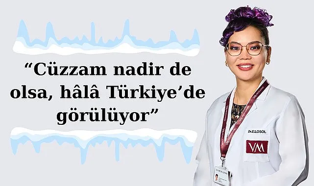 Uzman Doktor Egi Enkhjargal Losol: Cüzzam nadir de olsa, hâlâ Türkiye’de görülüyor