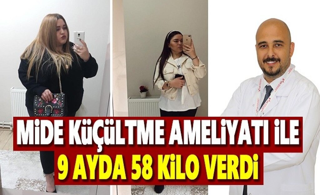 Mide Küçültme Ameliyatı ile 9 ayda 58 kilo verdi!