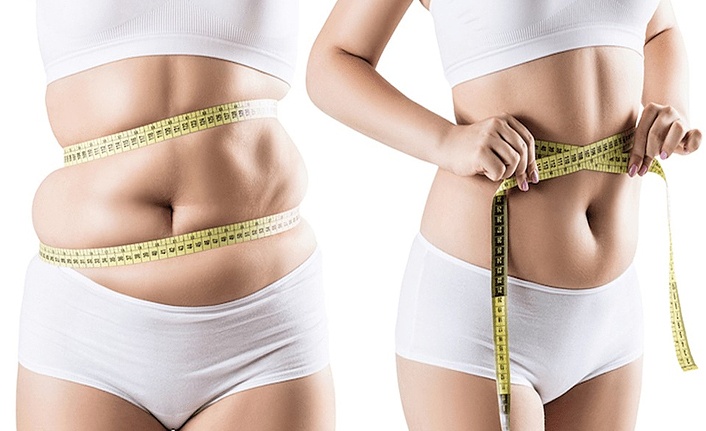 Liposuction İle Bölgesel Yağ Birikintilerinizden Kurtulabilirsiniz