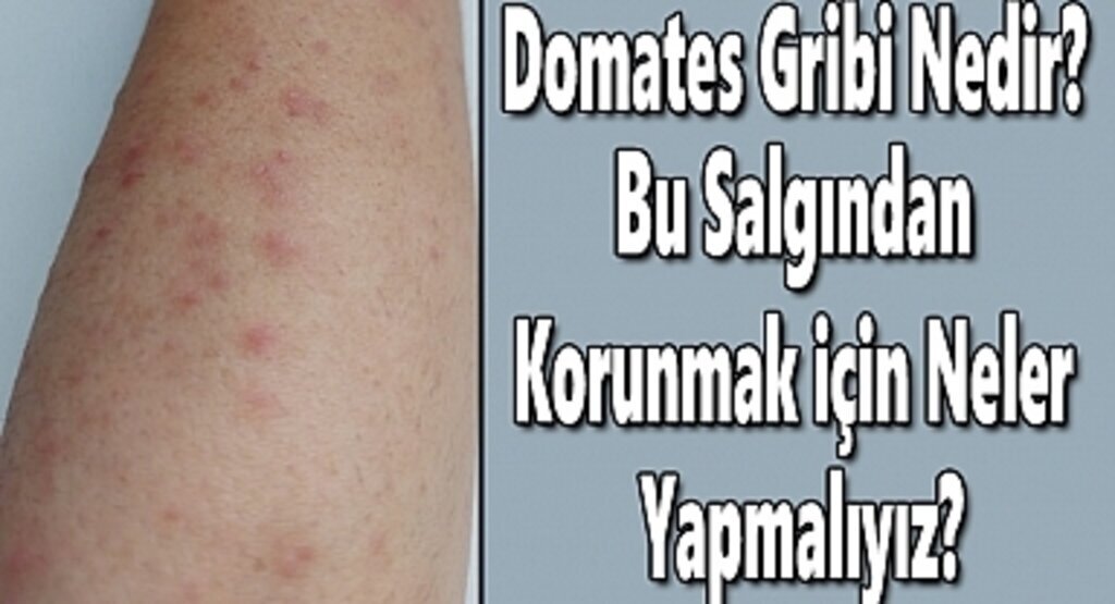 Domates Gribi Nedir? Domates Gribi Belirtileri