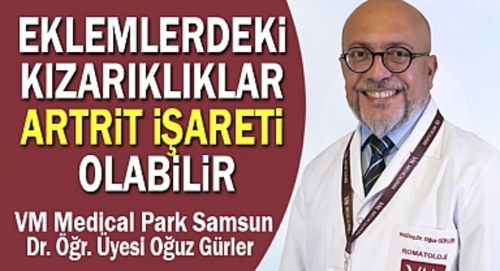 Artrit Nedir Tedavisi Nasıl Yapılır?