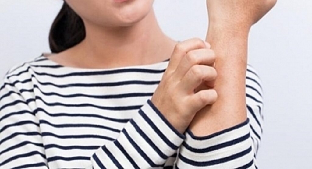 Neden kaşınıyorum? Kaşıntı Neden Olur? Kaşıntıya Ne İyi Gelir? Kaşınma tedavisi 