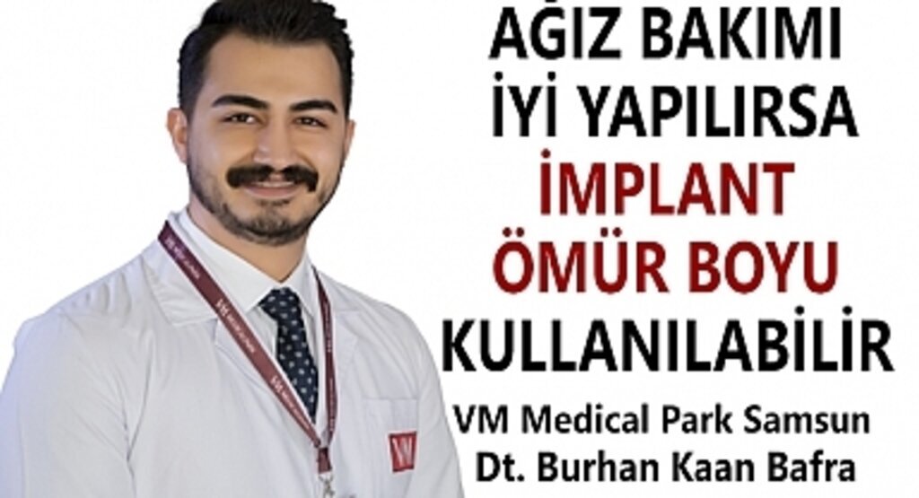 Ağız Bakımı İyi Yapılırsa İmplant Ömür Boyu Kullanılabilir