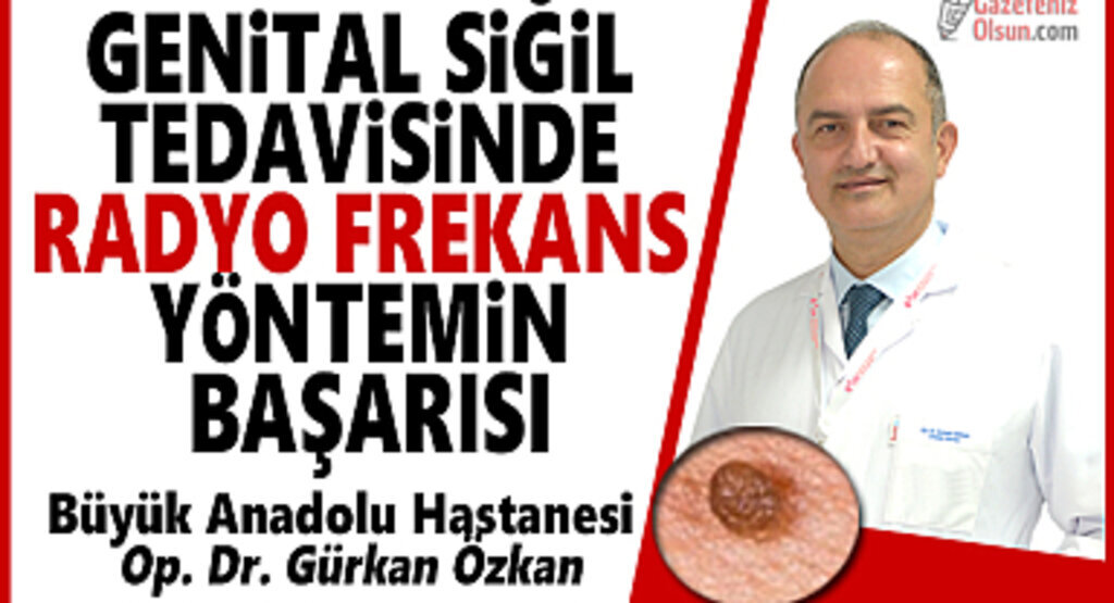 Genital Siğil Tedavisinde Radyo Frekans Yöntemin Başarısı