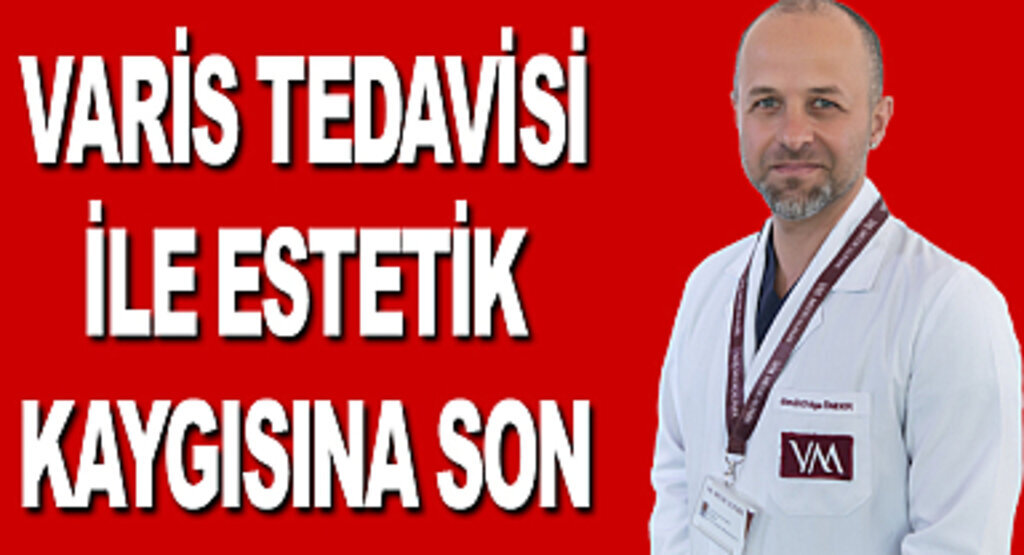 Varis tedavisi ile estetik kaygısına son