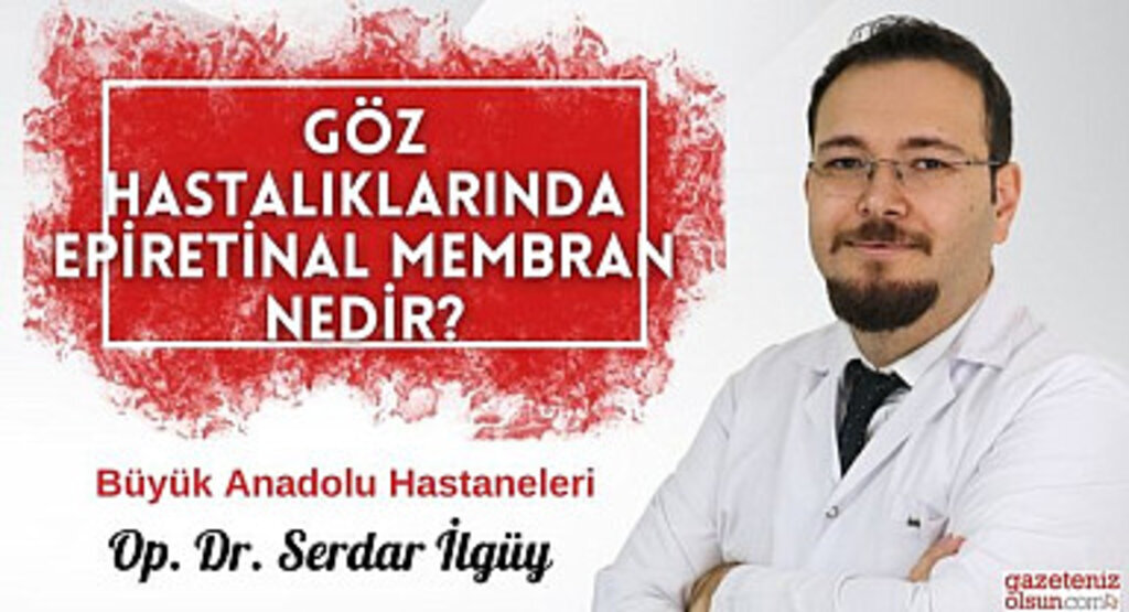 Göz Hastalıklarında Epiretinal Membran Nedir?