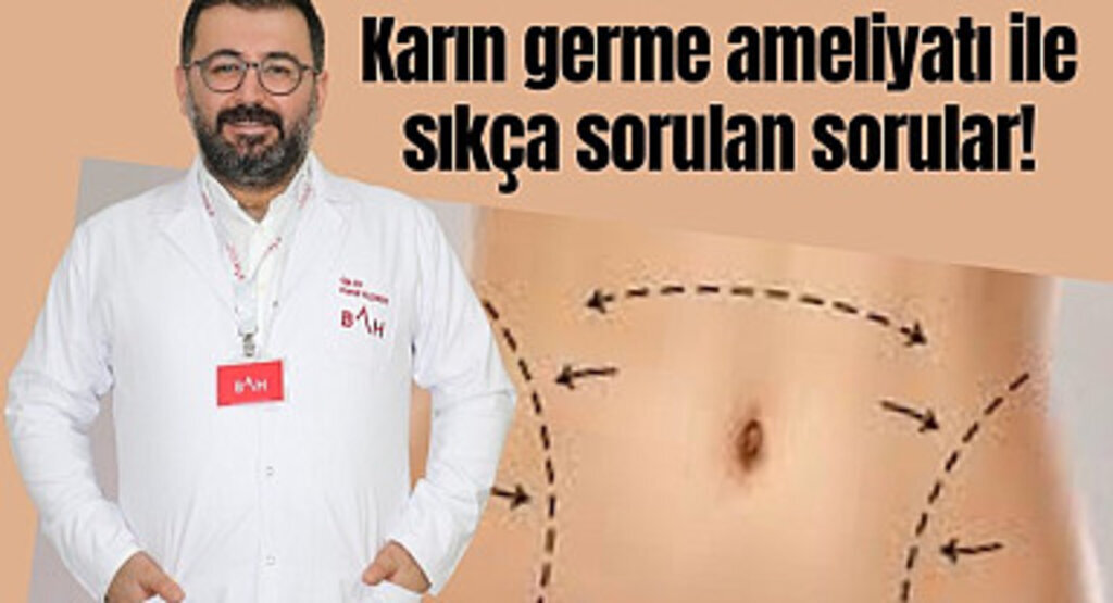 Karın germe ameliyatı ile sıkça sorulan sorular!
