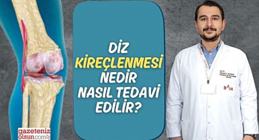 Diz Kireçlenmesi Nedir Nasıl Tedavi Edilir?