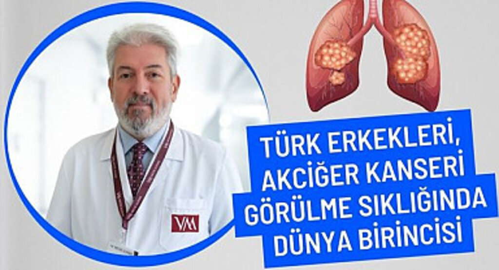 Türk erkekleri akciğer kanseri görülme sıklığında dünya birincisi