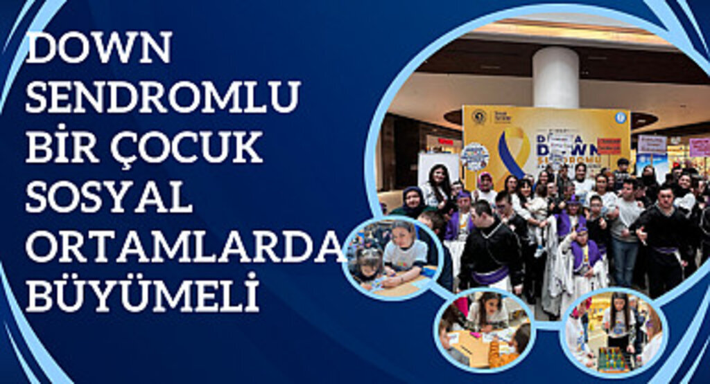 Down sendromlu bir çocuk sosyal ortamlarda büyümeli