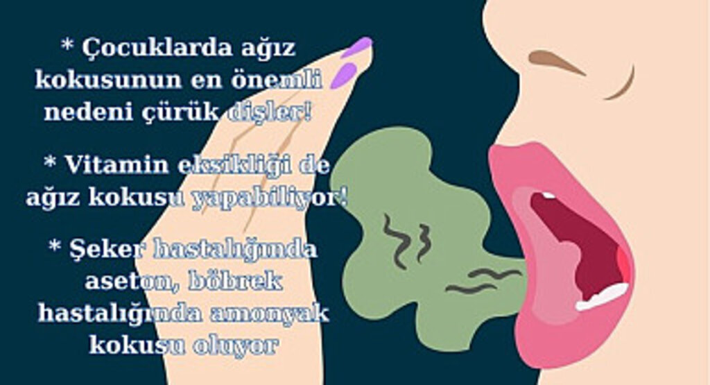 Ağız kokusu neden olur? Ağız kokusuna göre hastalıklar