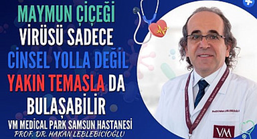 Maymun çiçeği virüsü nedir ve nasıl bulaşır?