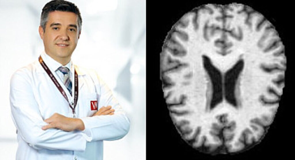 Alzheimer hastalığında erken teşhis önemli! Alzheimer nedir?