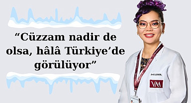 Uzman Doktor Egi Enkhjargal Losol: Cüzzam nadir de olsa, hâlâ Türkiye’de görülüyor