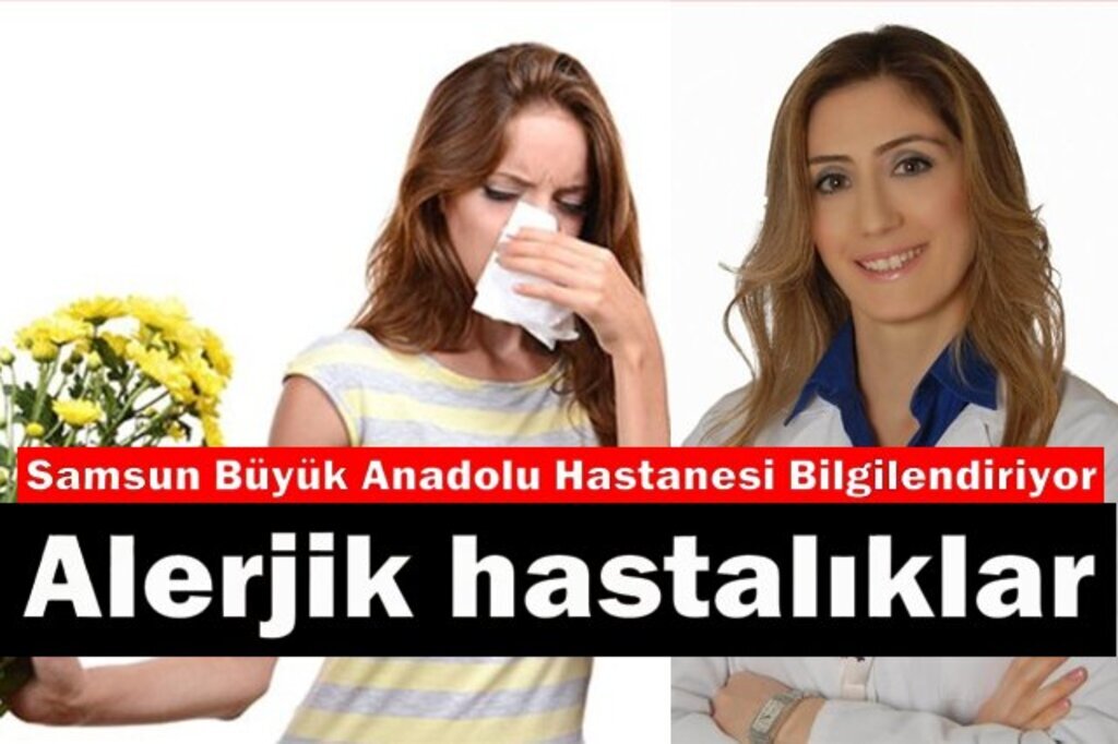 Samsun Büyük Anadolu Hastanesi Alerji Hastalığı ve Tedavisi