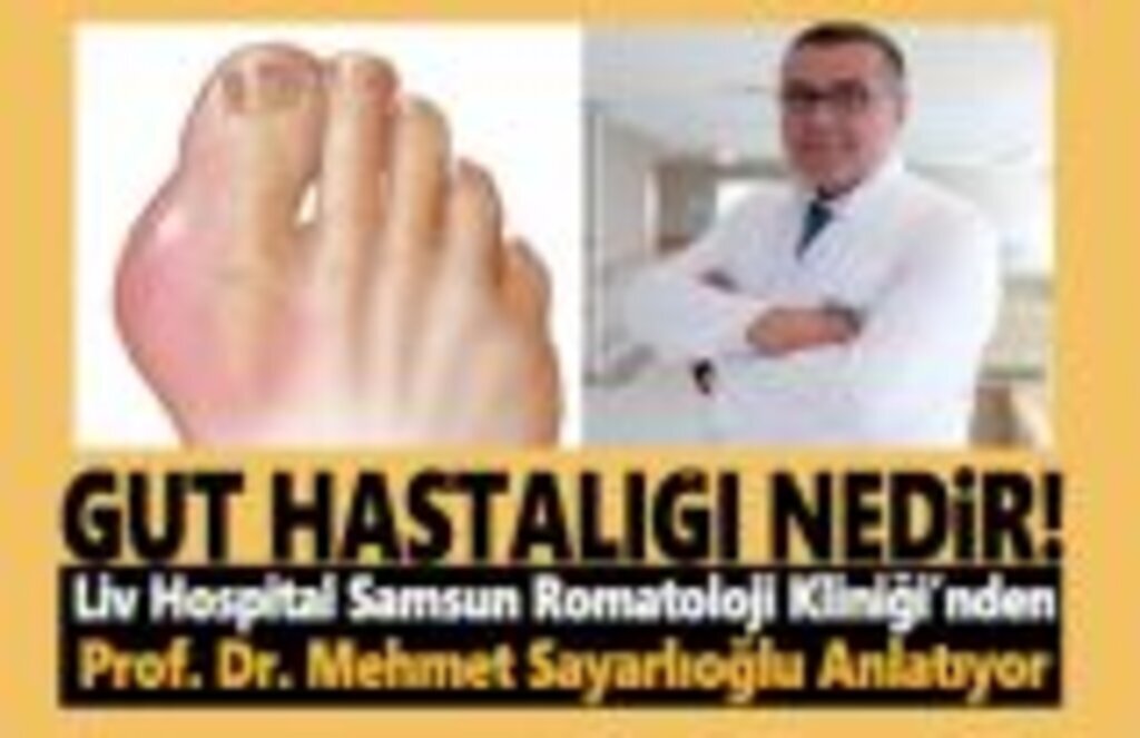 Liv Hospital Bilgilendiriyor,Gut Hastalığı Nedir!