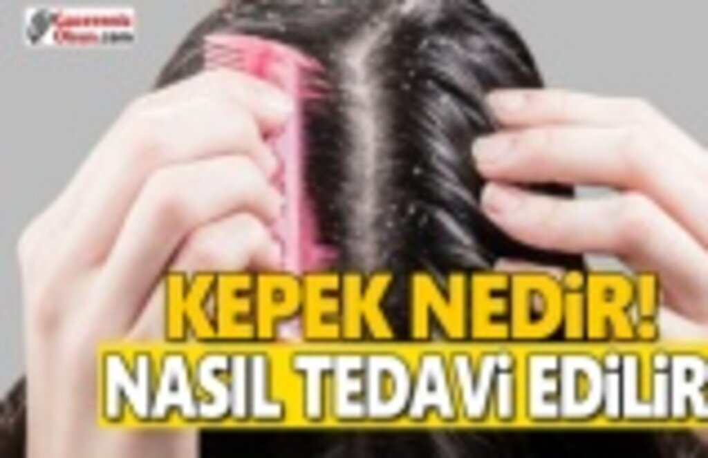 Kepek Nedir ! Kepekten Nasıl Kurtuluruz !