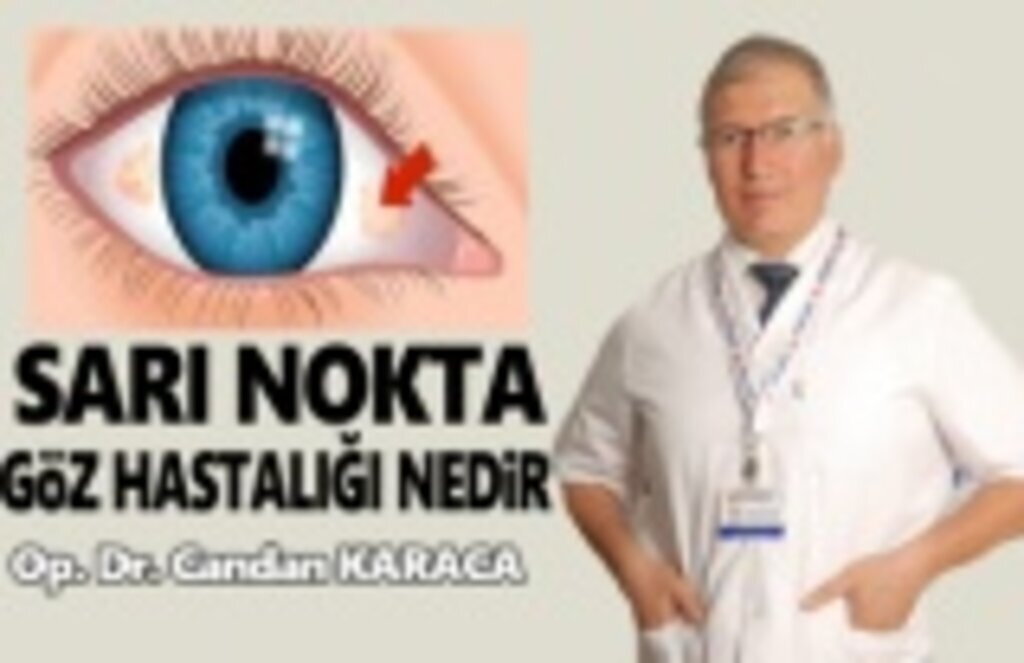 Sarı Nokta Göz Hastalığı Nedir ve Nasıl Anlaşılır!