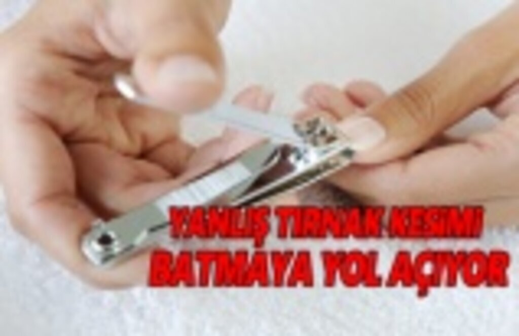 Tırnak Keserken Dikkat!