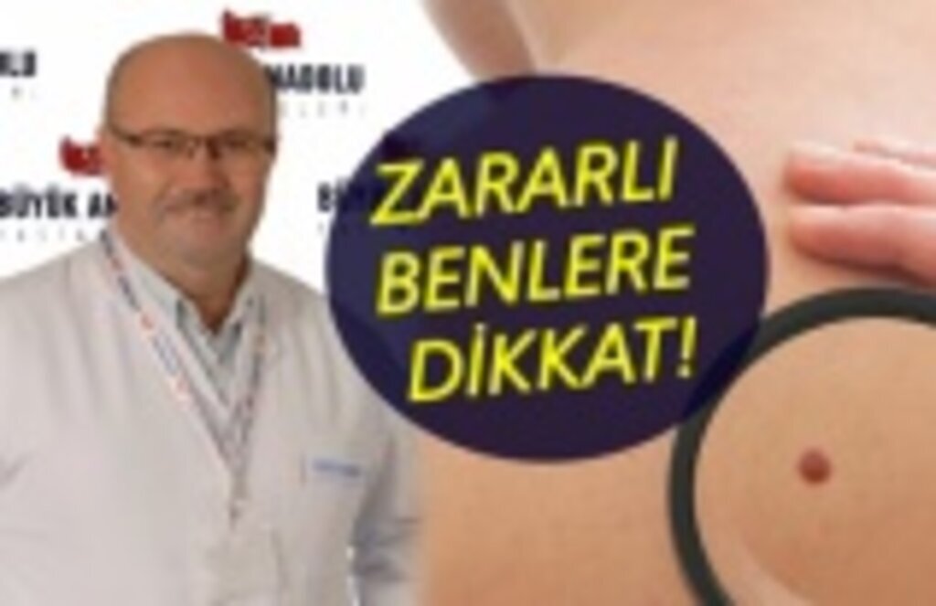Vücudunuzdaki benleri dikkate alın!
