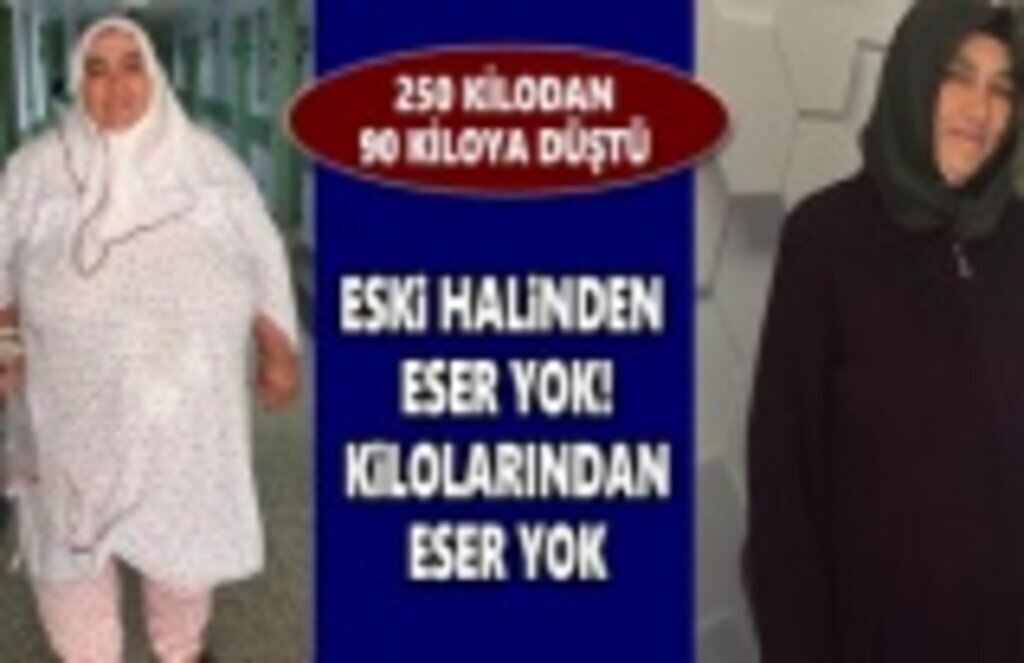 250 Kilodan 90 Kiloya Düştü