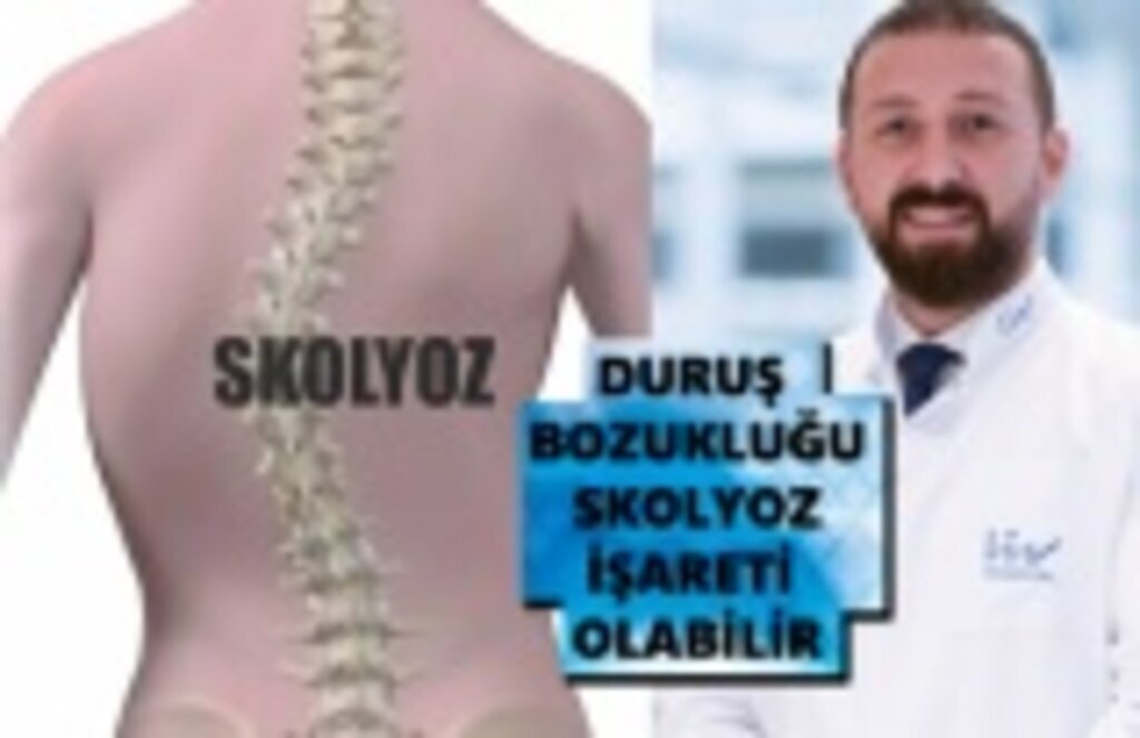 Skolyoz Nedir, Duruş Bozuklukları Neden Olur ?