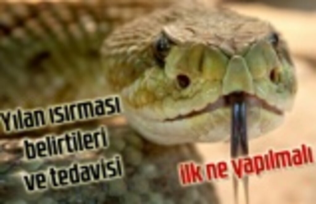 Yılan ısırmasında ne yapılmalı, Yılan ısırması belirtileri ve tedavisi
