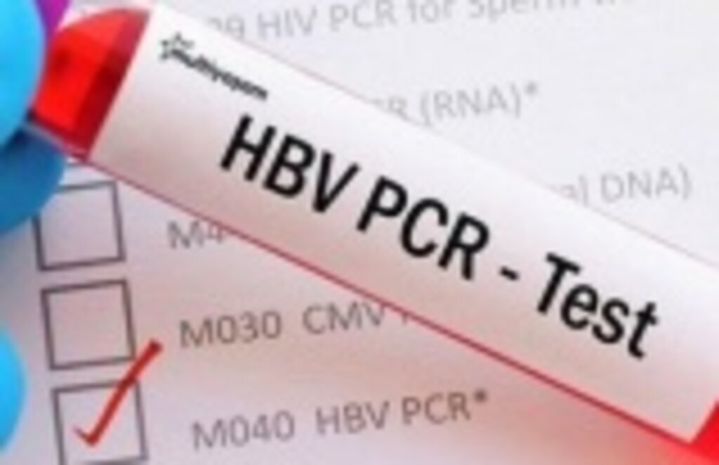 PCR testi pozitif çıkan hastanın tedavi ödemesi devletten, PCR Testi Nedir, Kimler Yaptırmalıdır