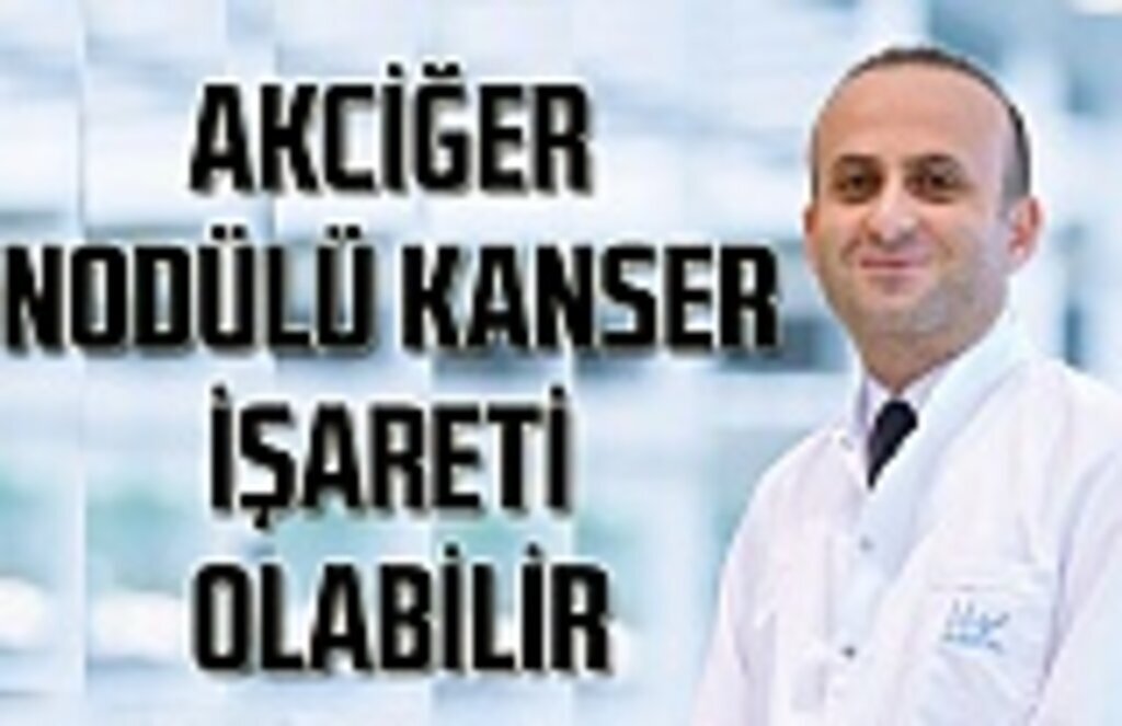 Akciğer nodülü kanser işareti olabilir