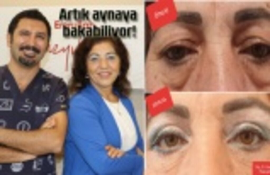 Artık aynaya bakabiliyor, özgüveni yerine geldi!