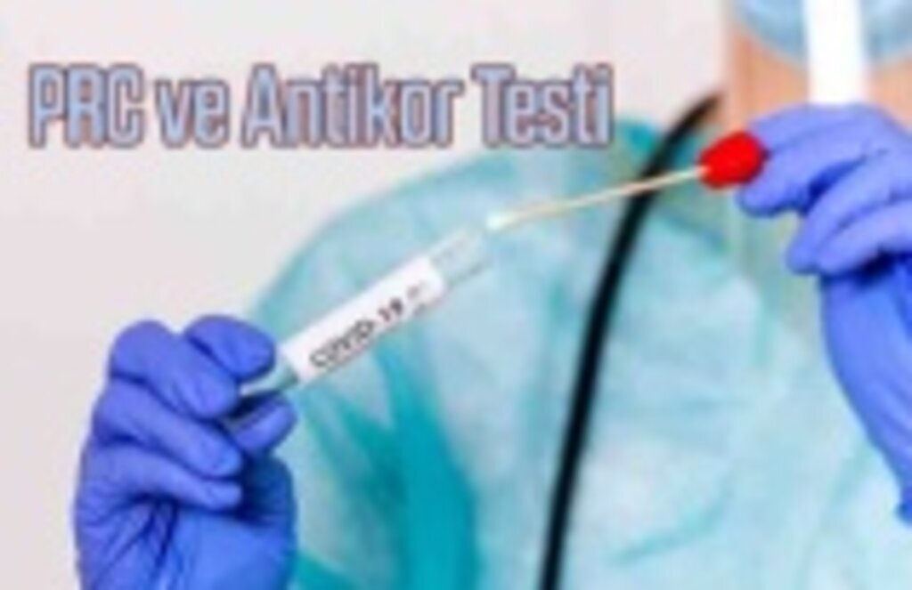 PRC ve Antikor Testi, yurt dışı ziyaretleri için gerekli Covid-19 test sonucu