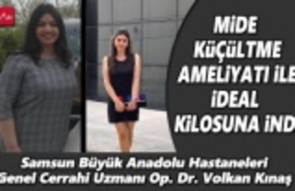 Büyük Anadolu Hastanesi'nde Mide küçültme ameliyatı ile ideal kilosuna indi