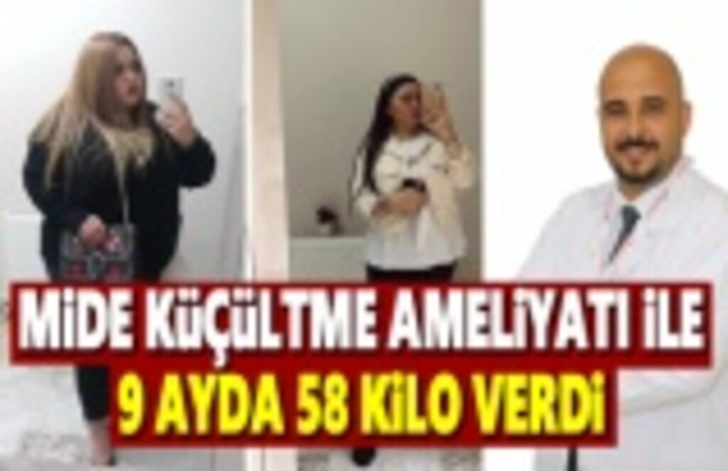 Mide Küçültme Ameliyatı ile 9 ayda 58 kilo verdi!