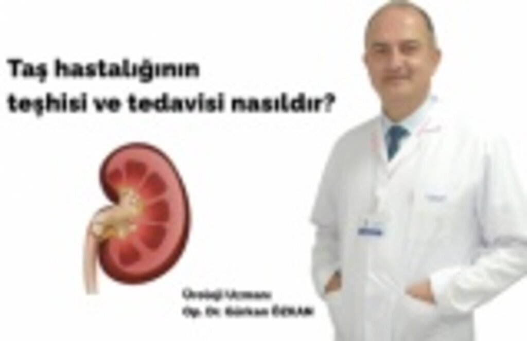 Taş hastalığının teşhisi ve tedavisi nasıldır?