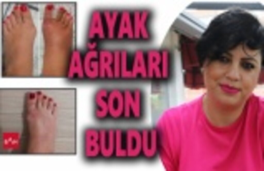 Anadolu Hastanelerine geldi, Ayak Ağrıları Son Buldu