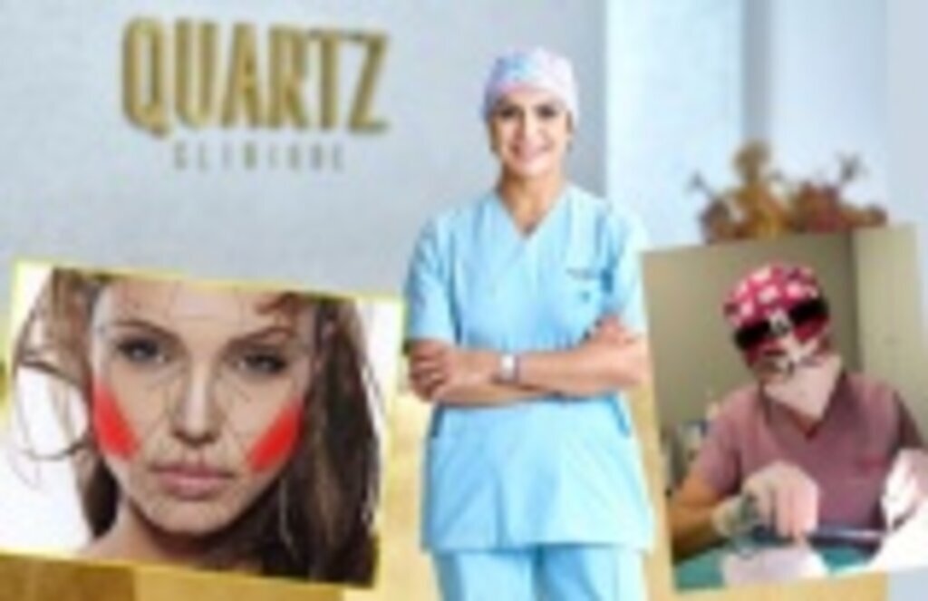 Tombul yanakları inceltmek Bişektomi ile Mümkün!!!