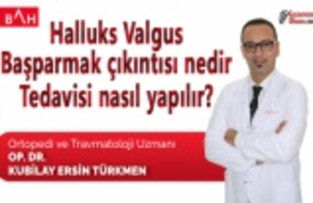 Halluks Valgus ya da başparmak çıkıntısı nedir, tedavisi nasıl yapılır?