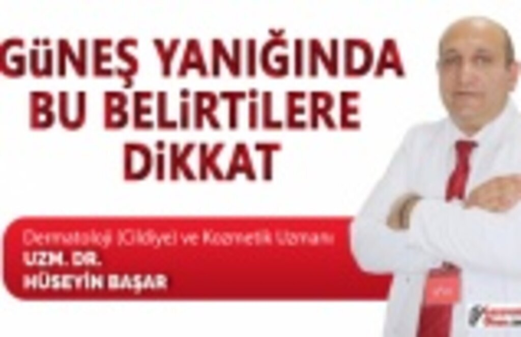 Güneş yanığında bu belirtilere dikkat!