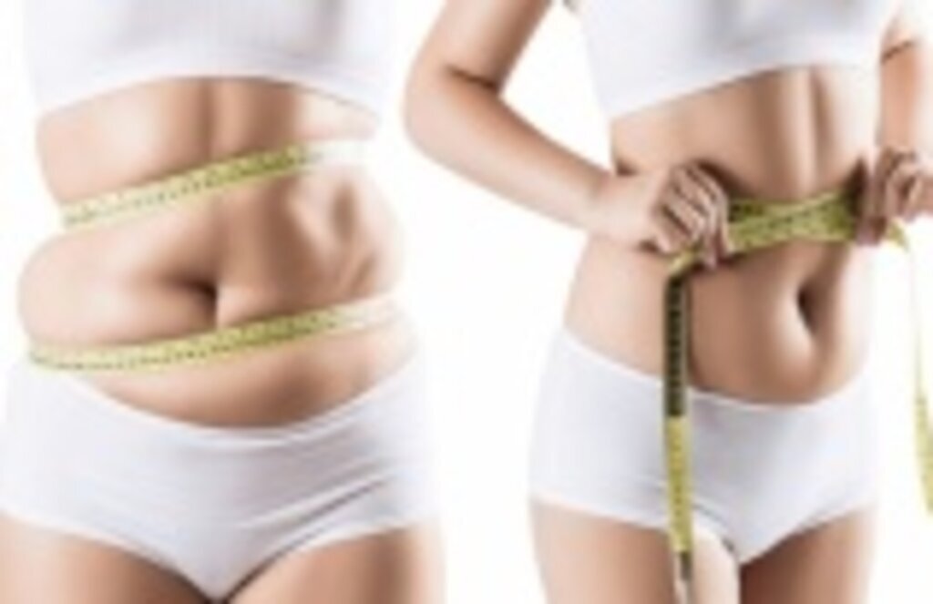 Liposuction İle Bölgesel Yağ Birikintilerinizden Kurtulabilirsiniz