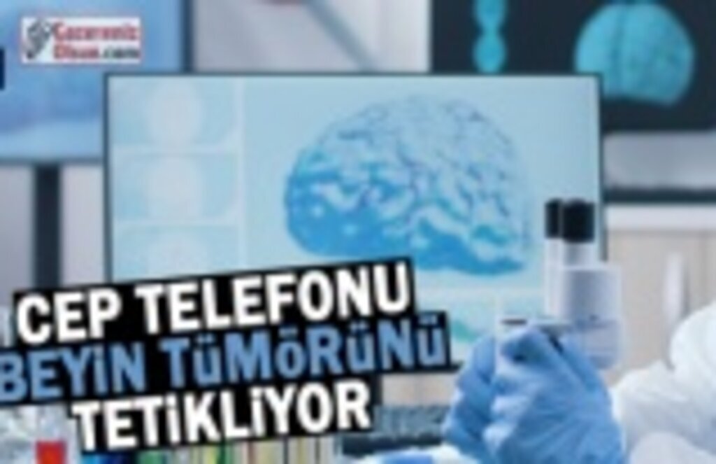 Cep telefonu beyin tümörünü tetikliyor