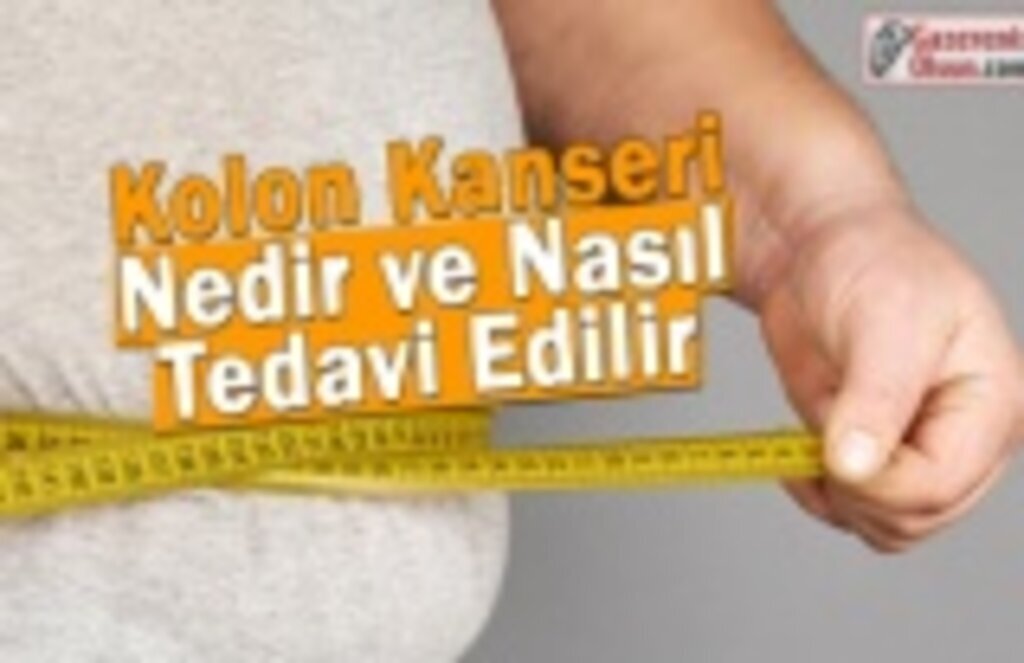 Kolon Kanseri Kolonoskopi Yöntemiyle Önlenebiliyor
