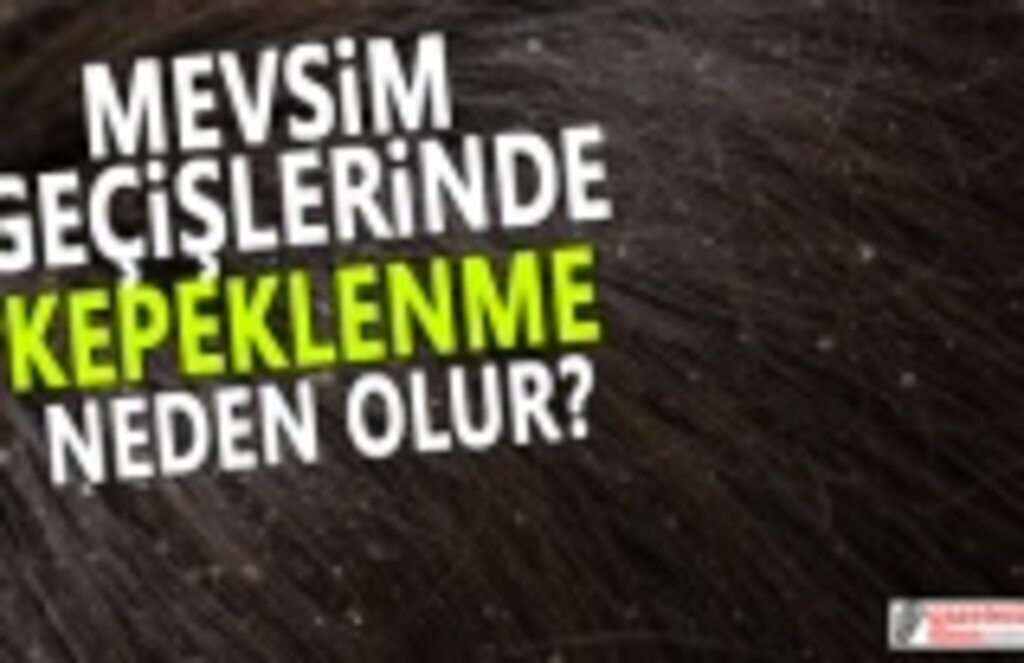 Mevsim geçişleri kepek sebebi olabilir tedavisi nasıl yapılır?